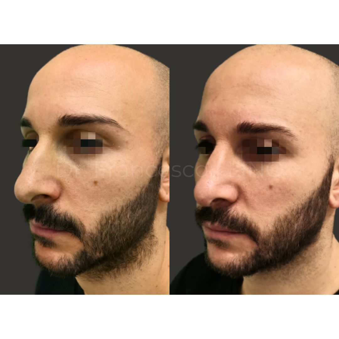 3-fotor-20240409142747